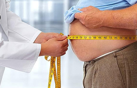 What are the common causes of Obesity?